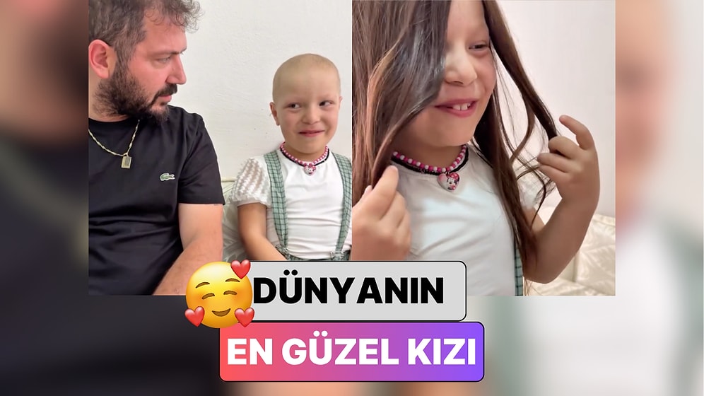 Saçı Olmadığı İçin Arkadaşlarının Kendisiyle Alay Ettiğini Söyleyen Miniğin Peruğuna Kavuştuğu Anlar