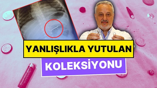 Ameliyatla Mideden Çıkardığı Yanlışlıkla Yutulan Cisimlerden Koleksiyon Yapan Doktor