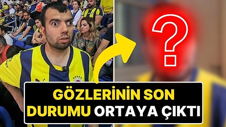 Göz Ameliyatı Olan “Kadıköy Boğası” Mustafa Başaran’ın Gözlerinin Son Durumu