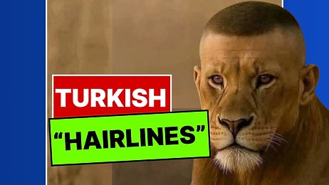 Yabancı Havayolu Şirketinin Türkiye'de Saç Ektiren Yolcuları Tiye Alan Paylaşımı X’te Gündem Oldu
