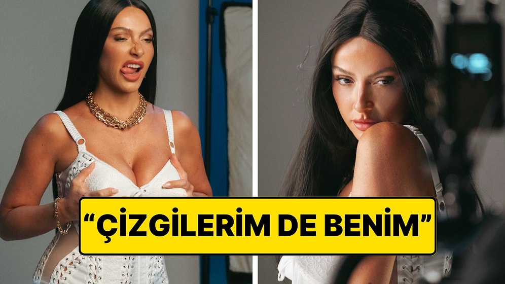 Hadise, Yüzündeki Kırışıklıklara Laf Edenlere Had Bildiren Bir Paylaşım Yaptı!