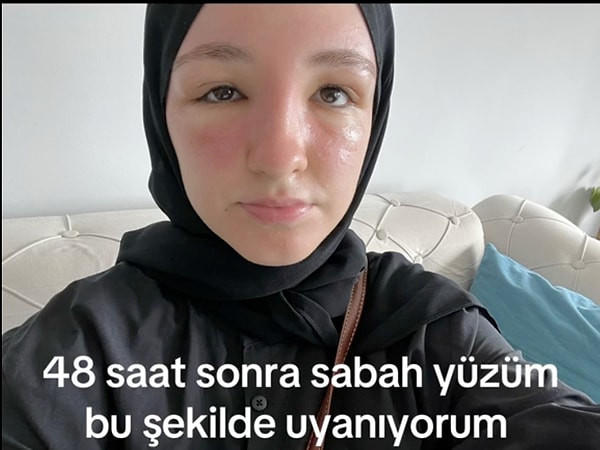 Özellikle öğle saatlerinde dışarı çıkılmaması gerekiyor.