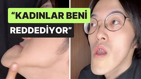 Dünyanın En Uzun Çeneli Adamı Uzun Bir Aradan Sonra Sessizliğini Bozdu