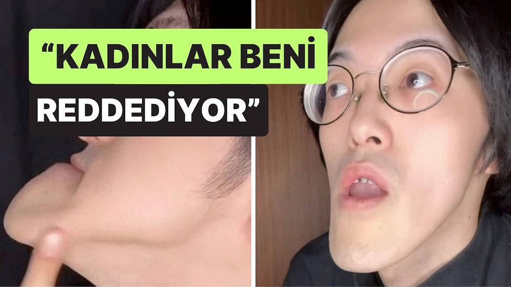 Dünyanın En Uzun Çeneli Adamı Uzun Bir Aradan Sonra Sessizliğini Bozdu