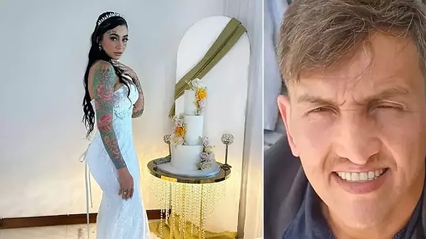 Burun ameliyatı için gitti, hayatını kaybetti.