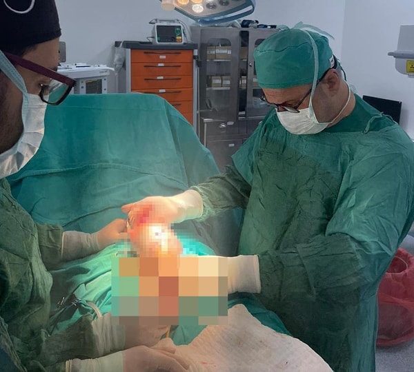 Kahramanmaraş'ta yaşayan 66 yaşındaki bir hastanın testisinde 20 santimetre çapında tümör tespit edildi.