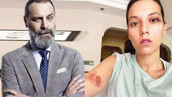 Ozan Güven'in Deniz Bulutsuz'u darbettiği abajur 'silah' sayıldı.