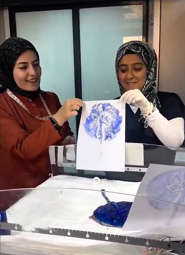 Her plasenta, tıpkı parmak izi gibi herkese özgü ve tekrarı mümkün olmayan bir desene sahip.