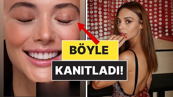 Sonunda Çıldırttılar: Rabia Soytürk, Estetik İddialarına Ateş Püskürdü!
