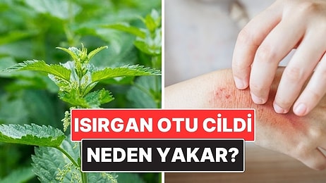 Isırgan Otu Neden Cildimizi Bu Kadar Fena Yakar?