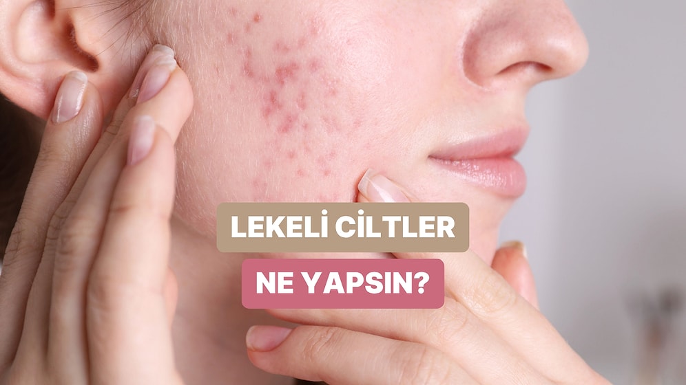 Leke Görünümüne Sahip Ciltlerin Uygulaması Gereken Etkili Bakım Rutini Önerileri