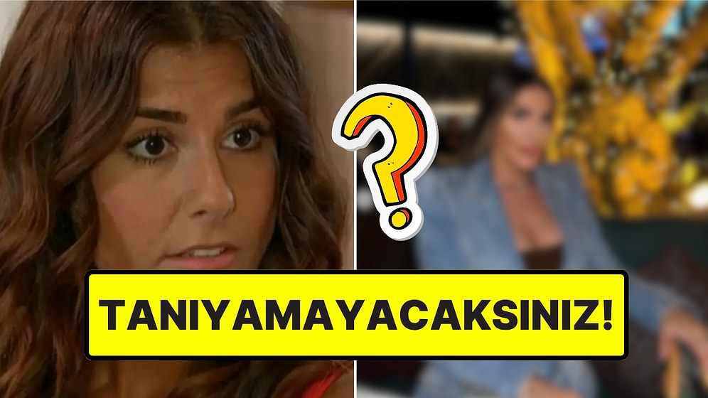 Adanalı'nın Pınar'ı Tuğçe Özbudak'ın Estetiği "Bi' Tık" Abarttığı Halleri Görenleri Şaşırttı
