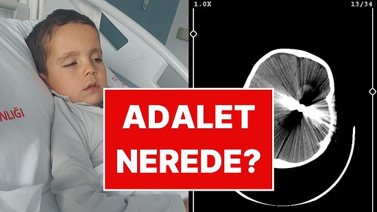 Yorgun Mermi 5 Yaşındaki Çocuğun Hayatını Kararttı: Gazeteci Emrullah Erdinç İsyan Etti