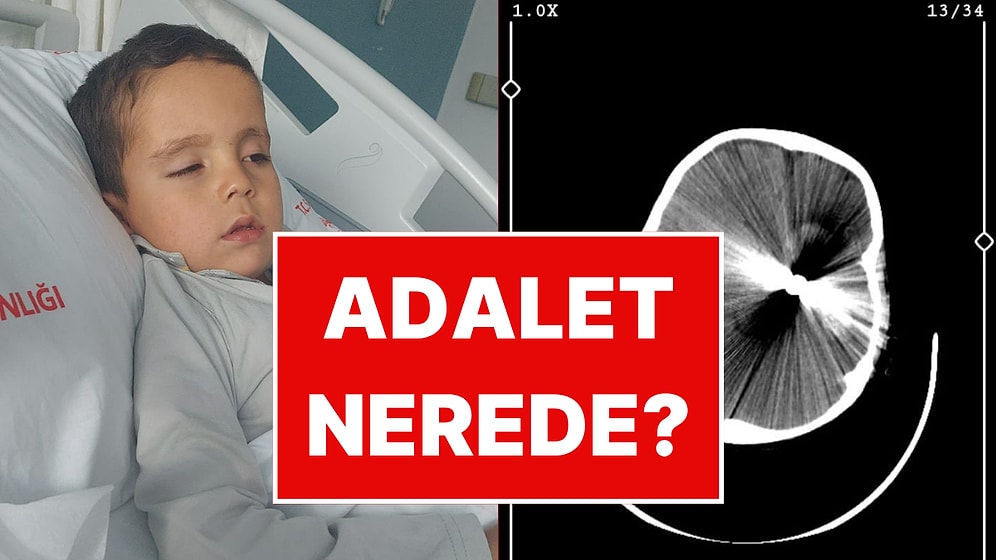 Yorgun Mermi 5 Yaşındaki Çocuğun Hayatını Kararttı: Gazeteci Emrullah Erdinç İsyan Etti