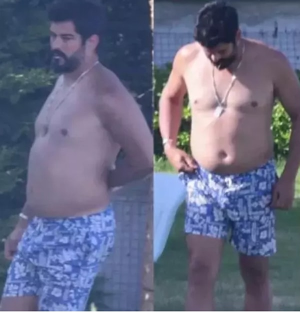 Burak Özçivit 2024 senesinin yazında da aldığı kilolarla magazin manşetlerine yerleşmişti hatırlarsanız.