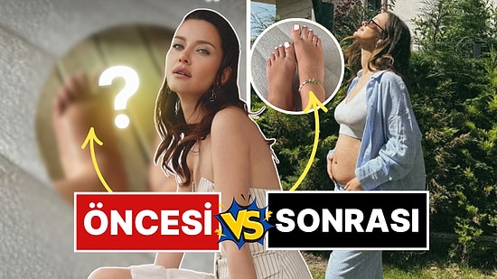 7 Aylık Hamile İrem Helvacıoğlu Hamilelikte Ödemden Kocaman Olan Ayaklarının Çaresini Bakın Ne ile Buldu?