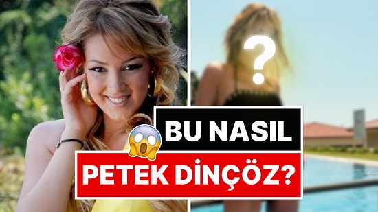 Estetikle Bambaşka Biri Olan Petek Dinçöz'ün Geldiği Son Hal Ağızları Açık Bıraktı!