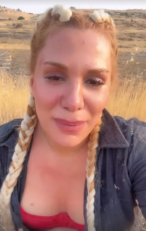 Survivor Almeda Baylan, dün Instagram hesabından yaptığı paylaşımla ölümden döndüğünü açıkladı.