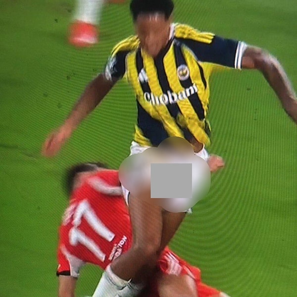 Fenerbahçe'nin Hollandalı savunmacısının ikili mücadelede geçirdiği iş kazası haliyle en az maç kadar konuşuldu.
