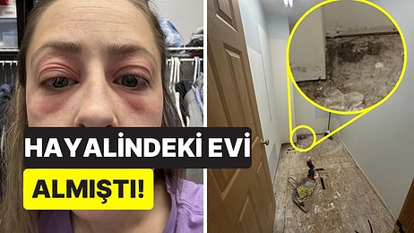 Hayallerini Kabusa Çevirdi: Yeni Aldığı Evdeki Küf Genç Kadının Sağlığını Mahvetti