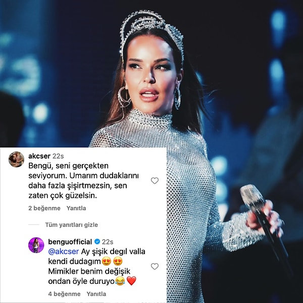 En çok da sevenleri tarafından fark ediliyor tabii... Geçtiğimiz saatlerde Bengü'yü çok sevdiğini belirten bir takipçisi, oku şişen dudaklarına çevirdi.
