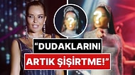 "Bari Sen Yapma N'olur": Ünlü Şarkıcı Bengü Son Pozlarında Şiştikçe Şişen Dudağıyla Dikkat Çekti!
