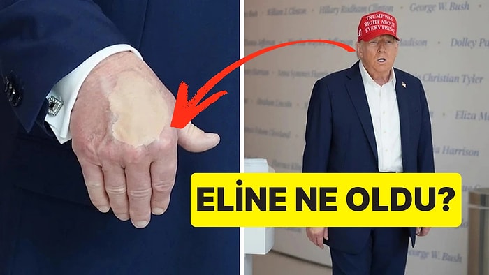 Hasta Olduğu Düşünülüyor: ABD Başkanı Donald Trump'ın Elindeki Fondöten Ne Anlama Geliyor?