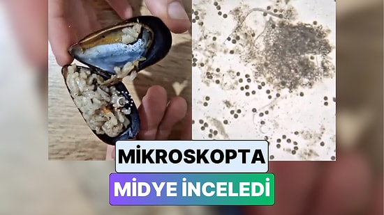 En Tartışmalı Yiyecek: Bir İçerik Üreticisi Yaz Aylarının Vazgeçilmezi Midyeyi Mikroskopta İnceledi