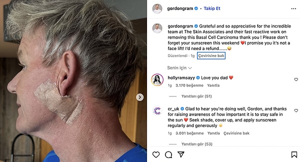 Michelin yıldızlı dünyaca ünlü şef Gordon Ramsay, kansere yakalandığını duyurdu. Ramsay, güneş kreminin önemine dikkat çekti.