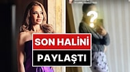 Beyninde Kitle Tespit Edildiğini Açıklayan Şarkıcı Lara, Son Halini Paylaştı