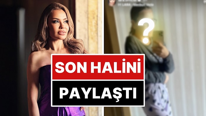 Beyninde Kitle Tespit Edildiğini Açıklayan Şarkıcı Lara, Son Halini Paylaştı