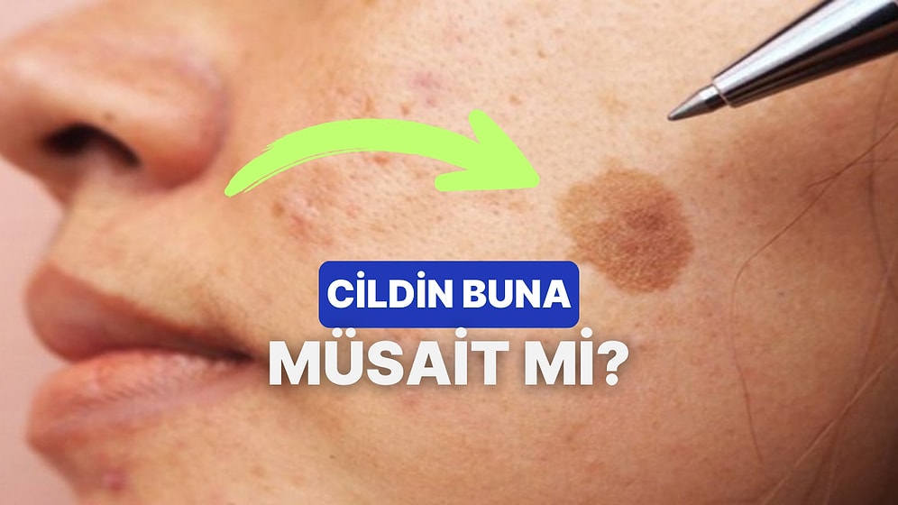 Leke Görünümüne Ne Kadar Yatkınsın?