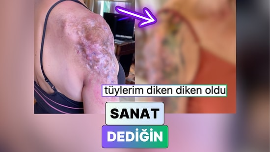 Tüm İzler Geride Kalmış: Bir Dövme Sanatçısının Yara İzi Üzerine Yaptığı Çalışma Beğeni Topladı