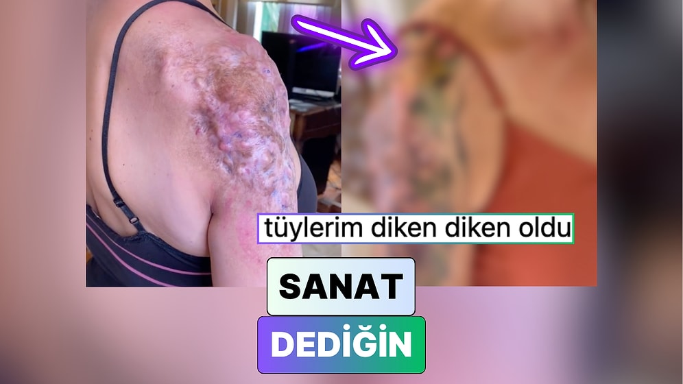 Tüm İzler Geride Kalmış: Bir Dövme Sanatçısının Yara İzi Üzerine Yaptığı Çalışma Beğeni Topladı