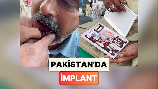 İmplant Bile Yapıyor: Pakistan'daki Sokak Dişçisinin Yaptığı İşlem Fiyatıyla Kafa Karıştırdı