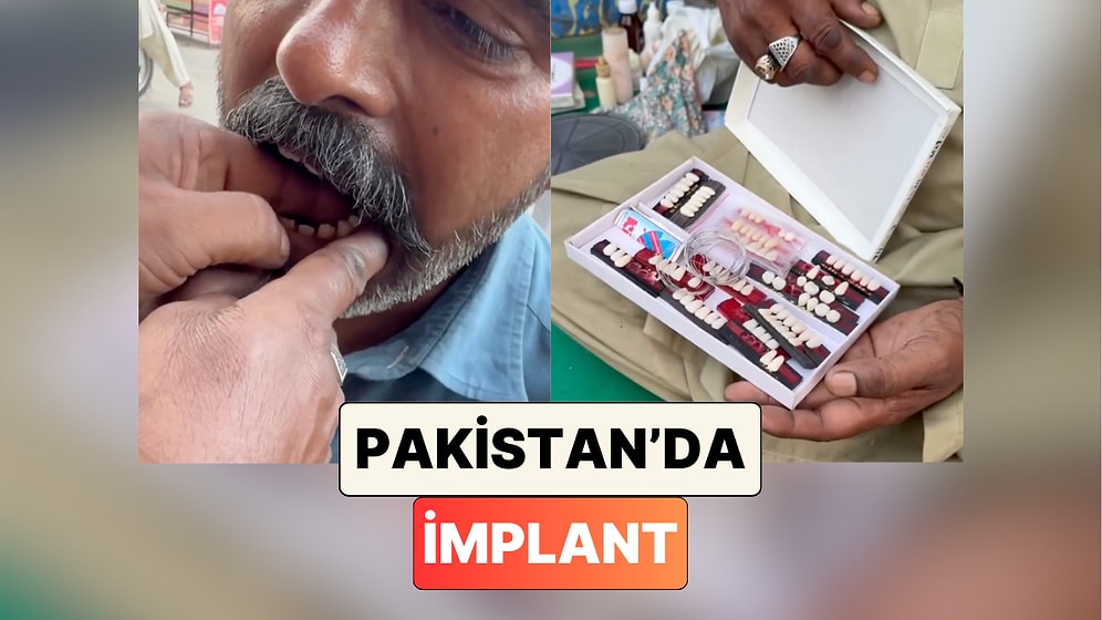 İmplant Bile Yapıyor: Pakistan'daki Sokak Dişçisinin Yaptığı İşlem Fiyatıyla Kafa Karıştırdı