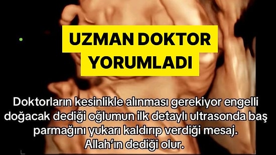 Peritanoloji Uzmanı Sosyal Medyada Konuşulan Ultrason Fotoğrafını Yorumladı