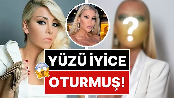 Son Hali Şoka Soktu: 9 Saatlik Operasyonla Kendini Baştan Yaratan Gülşah Saraçoğlu'nun Yüzü İyice Oturdu!