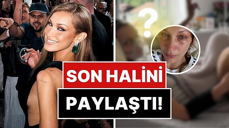 Lyme Hastalığıyla Mücadele Ettiğini Açıklayan Bella Hadid, Son Halini Paylaştı!