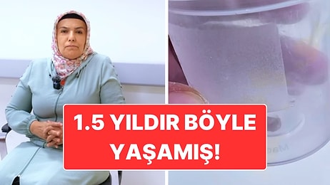 1.5 Yıldır Geçmeyen Öksürüğün Sebebi Şaşırttı: Akciğerine Kabak Çekirdeği Yapışan Hasta