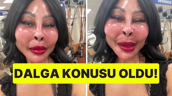 Cam Gibi Görünen Bir Cilt İstiyordu: Sosyal Medya Fenomeni Fena Dalga Konusu Oldu