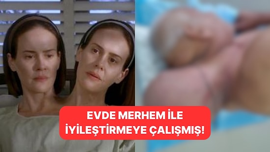 16 Yıl Boyunca Hastaneye Gitmeyen Adamın “İkinci Kafa” Büyüklüğündeki Tümörü Alındı