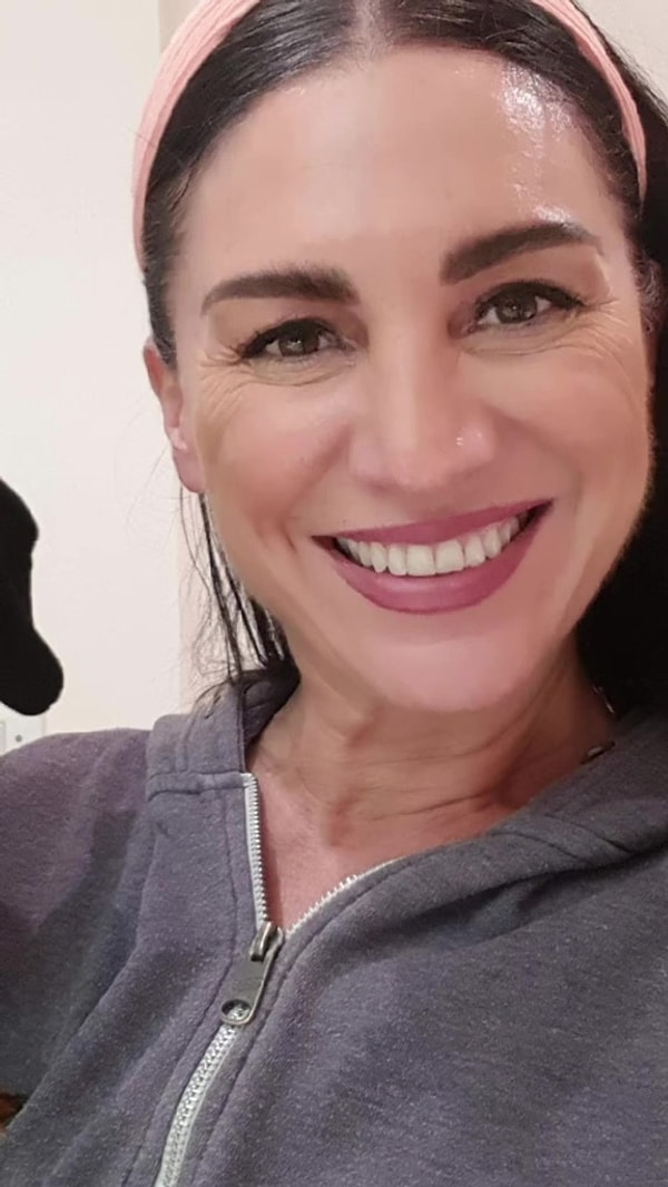 “Yaşlanmayla birlikte çene geriliyor, elmacık kemikleri daha belirginleşiyor, şakaklar ve gözler çöküyor. Bu da bende sanki göz kapağı ameliyatı olmuşum gibi bir etki yarattı” diye açıkladı.