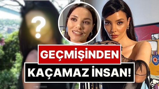 İnatla Yüzünde Bir Tane Bile Estetik Olmadığını İddia Eden Hazal Filiz Küçükköse'nin Eski Hali