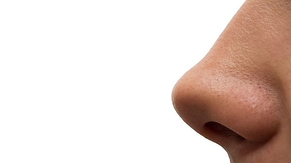 2. Siyah noktalarla başa çıkma yöntemini seç!