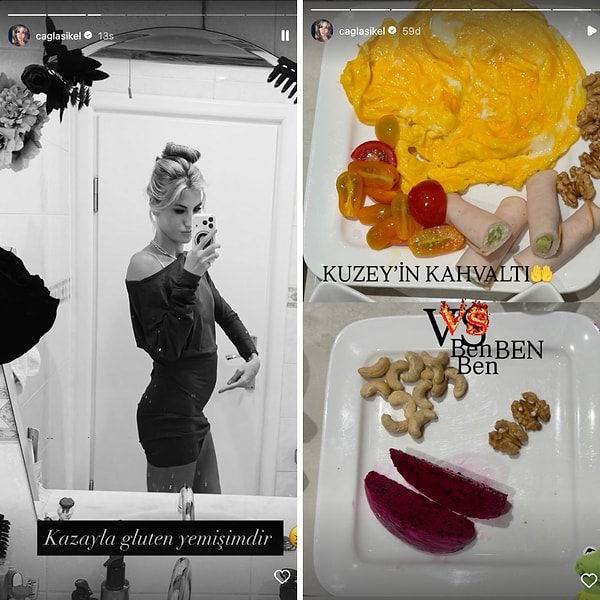 Çağla Şıkel, bu sefer de "yanlışlıkla" gluten yedikten sonraki yakınmasıyla dikkat çekti.