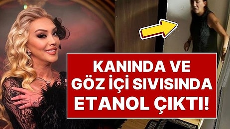 Evinin Camından Düşerek Hayatını Kaybeden Şarkıcı Güllü’nün Adli Tıp Raporu Ortaya Çıktı