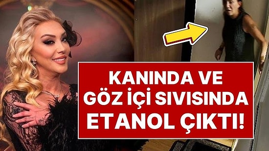 Evinin Camından Düşerek Hayatını Kaybeden Şarkıcı Güllü’nün Adli Tıp Raporu Ortaya Çıktı