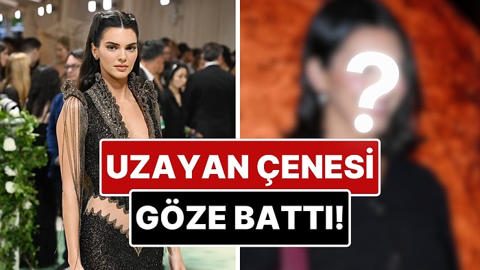 Uzayan Çenesi Göze Battı: Kendall Jenner'ın Yüzünün Son Hali Estetik İddialarını Gündeme Taşıdı!