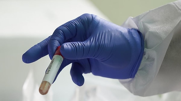 Uyuşturucu Testi Kaç Günde Çıkar?